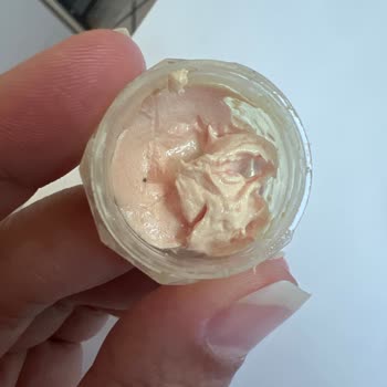 Aldığım Ürün Cildimde Ciddi Sorunlara Yol Açtı, Eczane İlgisiz Kaldı