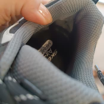 Skechers Ayakkabı Sürekli Yara Yaptı Mağaza Sorumluluğu Kabul Etmiyor