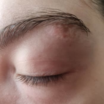 Ben Aldırma İşlemi Yarım Kaldı Ek Ücret İstendi Doktor İlgisiz Davrandı