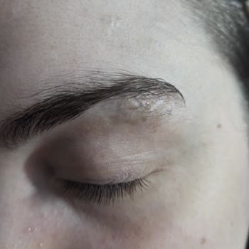 Ben Aldırma İşlemi Yarım Kaldı Ek Ücret İstendi Doktor İlgisiz Davrandı