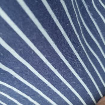 Benetton Çantanın Fermuarı Kıyafetlerimi Mahvetti