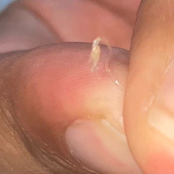 Migros Uzman Kasaptan Alınan Köftede Kemik Ve Yabancı Madde Şoku