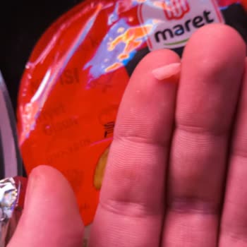 Maret Macar Salamdan Çıkan Kemik Sağlığımı Tehdit Etti