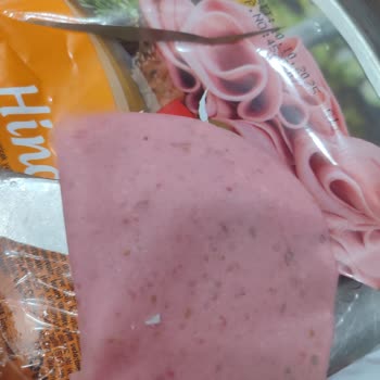 Aldığım Üründe Yabancı Madde Çıktı, Daha Steril Üretim Bekliyorum