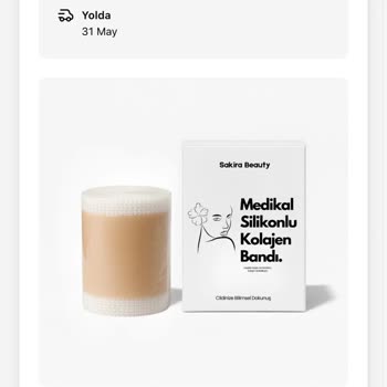 Siparişim Kayboldu, Bilgilendirme Sıfır!