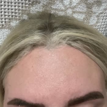 Hilal İpek Beauty Center Kaşlarımın Altın Oranı Bile Alınmadan İşlem Yapıldı