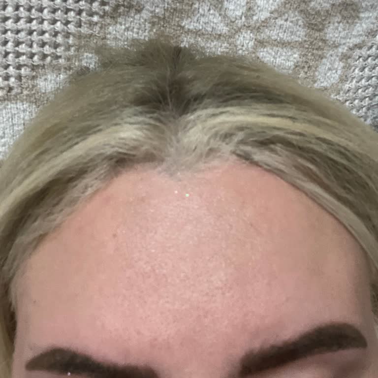 Hilal İpek Beauty Center Kaşlarımın Altın Oranı Bile Alınmadan İşlem Yapıldı