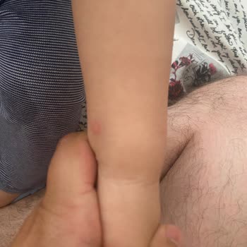 Sivrisinek Sorunu Ve Yetersiz İlaçlama Nedeniyle Bebeğimiz Risk Altında