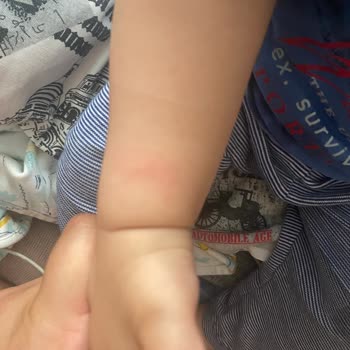 Sivrisinek Sorunu Ve Yetersiz İlaçlama Nedeniyle Bebeğimiz Risk Altında