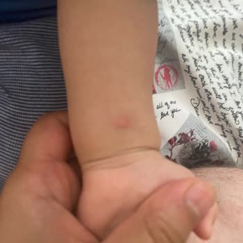 Sivrisinek Sorunu Ve Yetersiz İlaçlama Nedeniyle Bebeğimiz Risk Altında