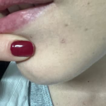 Garnier C Vitamini SPF Ürünü Cildimde Kuruluk Ve Tahrişe Neden Oldu