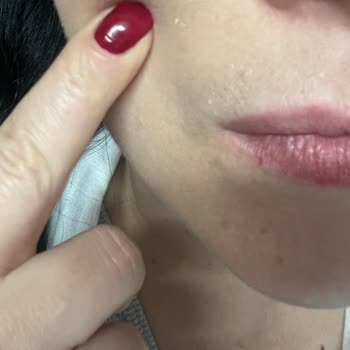 Garnier C Vitamini SPF Ürünü Cildimde Kuruluk Ve Tahrişe Neden Oldu