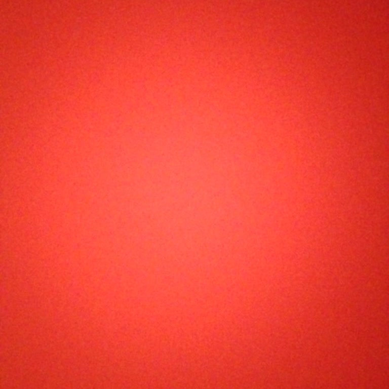 Hesabımda Bloke Edilen Param Ve Yetersiz Müşteri Hizmeti