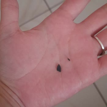 Aldığım Jelibonun İçinden Taş Çıktı, Şikayetim Dikkate Alınmadı