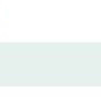 Referans Kampanyasında Hak Edilen Puan Hesabıma Yatmadı