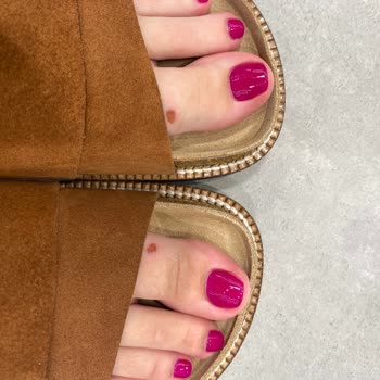 İlk Kullanımda Yaralanmaya Sebep Olan Terlik İçin Değişim Talebimin Reddedilmesi