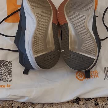 İlk Kullanımda Ayağımı Yaralayan Konforsuz Ayakkabı