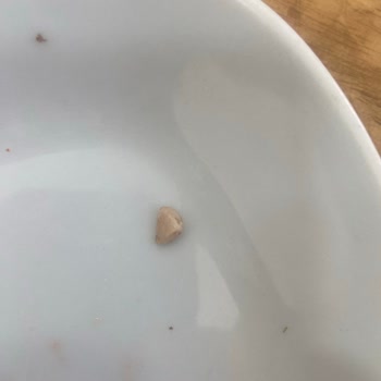 Öz Karadeniz Et Lokantası Dönerde Kemik Çıktı