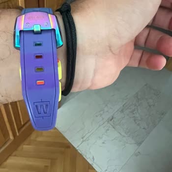 Garanti Kapsamında Saat Kayışımın Değişimi Reddedildi