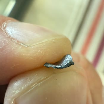 Sucukta Çıkan Metal Parçası Nedeniyle Yaşanan Sağlık Riski Endişesi