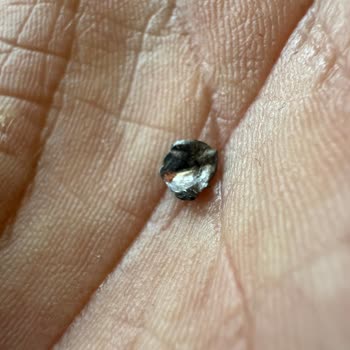 Sucukta Çıkan Metal Parçası Nedeniyle Yaşanan Sağlık Riski Endişesi