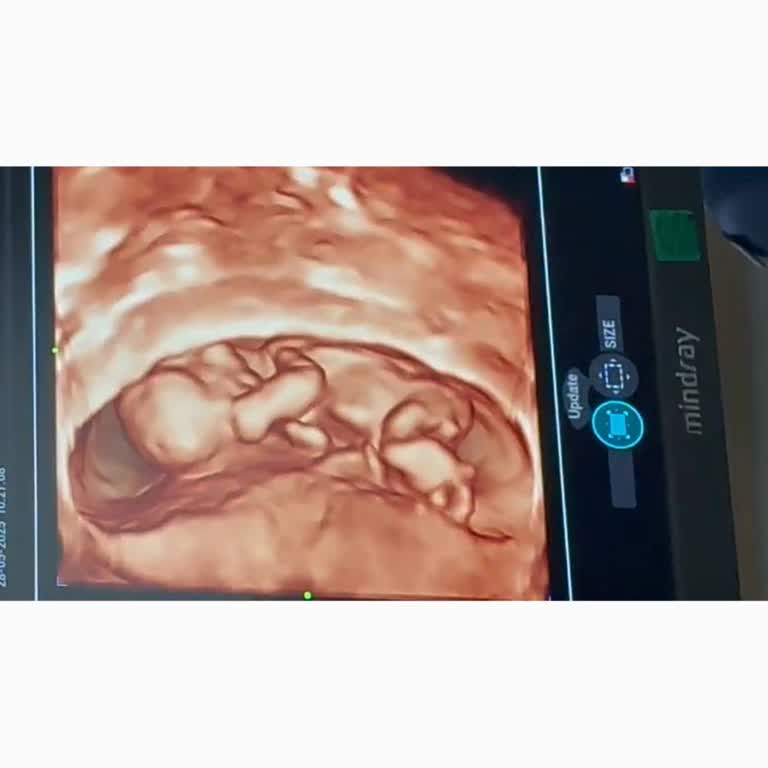 Yanlış Tedavi Sonucu Yaşanan Büyük Kayıp