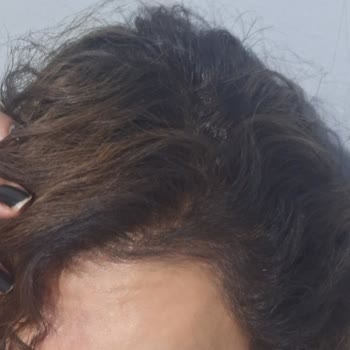 Yirmiyedi Ankara Kuaför Yüksek Ücret, Hatalı Boya Ve Saçta Büyük Hayal Kırıklığı!