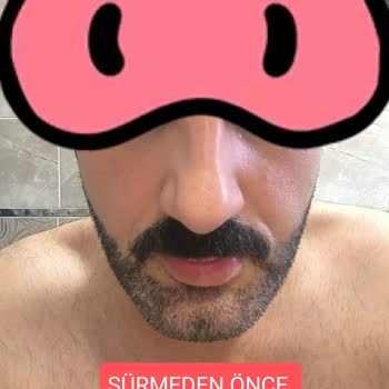 Cream Line Kozmetik Yüzümde Koca Bir Ben Oluştu