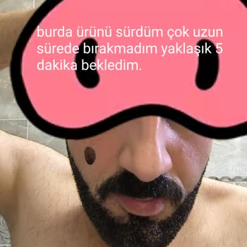 Cream Line Kozmetik Yüzümde Koca Bir Ben Oluştu