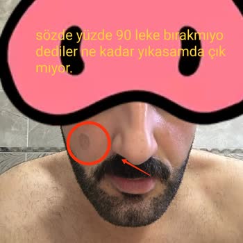 Cream Line Kozmetik Yüzümde Koca Bir Ben Oluştu