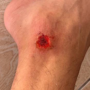 Acil Serviste Yetersiz Müdahale Ve İlgisizlik