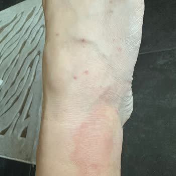 Booking.com Konaklama Yerinde Böcek İstilası Ve İlgisiz Müşteri Hizmetleri Mağduriyeti