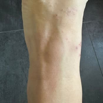 Booking.com Konaklama Yerinde Böcek İstilası Ve İlgisiz Müşteri Hizmetleri Mağduriyeti