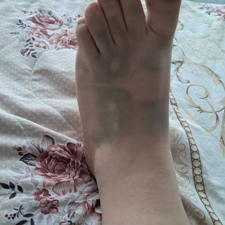 Polaris Terlik Ayağımı Boyuyor Ve Değişim Yapılmadı