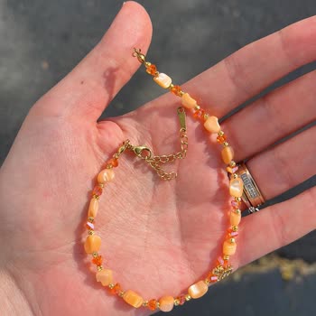 Aldığım Halhal Sürekli Koptu, Satıcı Yardımcı Olmadı