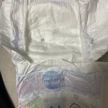 Molfix Bebek Bezinin İçinden Çıkan Sert Cisim Endişesi