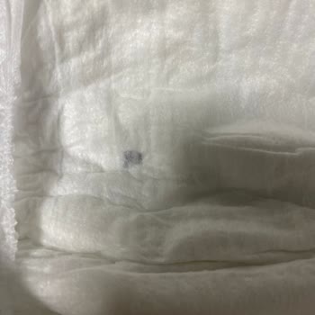 Molfix Bebek Bezinin İçinden Çıkan Sert Cisim Endişesi