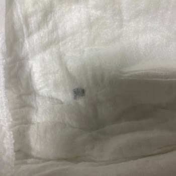 Molfix Bebek Bezinin İçinden Çıkan Sert Cisim Endişesi