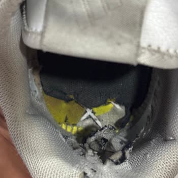 Adidas Ayakkabılarda Kronik Yırtılma Sorunu Ve Garanti Reddi