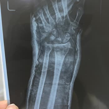 Parnassius Hotel'den Şikayetçiyim