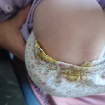 Sleepy Bebek Bezinde Sızdırma Ve Taşıma Sorunu Yaşıyorum