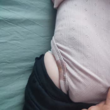 Sleepy Bebek Bezinde Sızdırma Ve Taşıma Sorunu Yaşıyorum