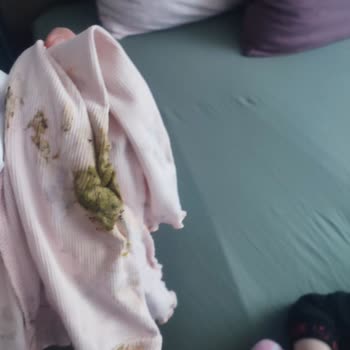 Sleepy Bebek Bezinde Sızdırma Ve Taşıma Sorunu Yaşıyorum