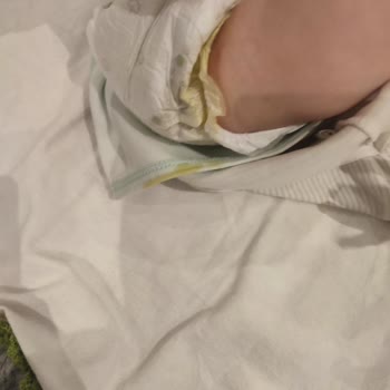 Sleepy Bebek Bezinde Sızdırma Ve Taşıma Sorunu Yaşıyorum