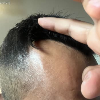 Özcan Zencirli Hair & Macke-up Protez Saçımı Yapıştıramadı