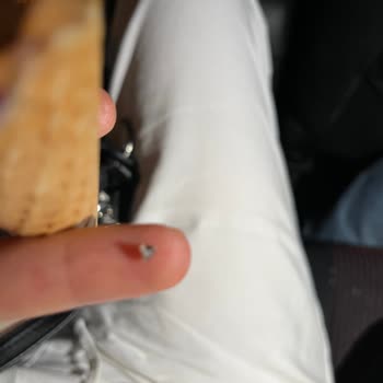 Dondurmadan Çıkan Taş Dişimi Kırıyordu