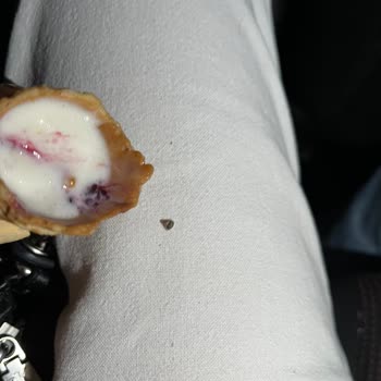 Dondurmadan Çıkan Taş Dişimi Kırıyordu