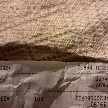 Burcu Aşure Sonrası Yaşadığım Ciddi Sağlık Sorunları!