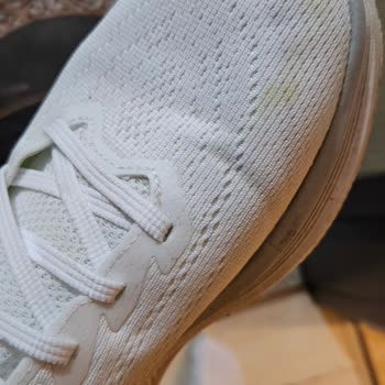Skechers Ayakkabı Çoraplarımı Ve Ayağımı Boyadı Çözüm Bekliyorum