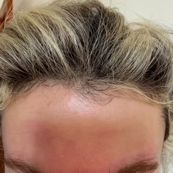 Yves Rocher Yüz Yıkama Jeli Cildimi Yaktı Ve Kızarttı